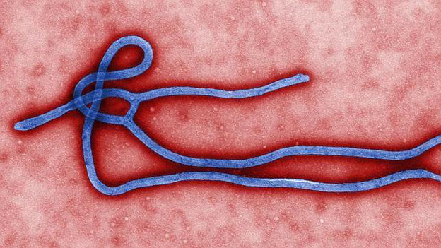 El virus del ébola.